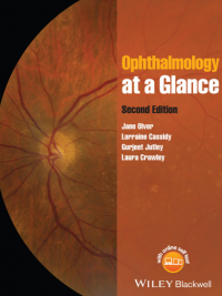 Ophthalmology at a Glance