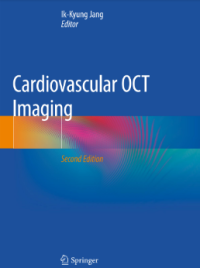 Cardiovascular OCT Imaging