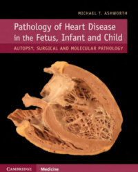 Pathology of Heart Disease inthe Fetus,
Infant and Child