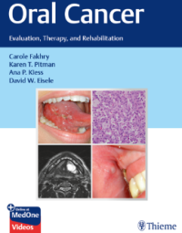 Oral Cancer Evaluation, Therapy, and Rehabilitation